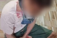 Korban dengan kondisi berlumuran darah usai dihajar oleh pelaku. (Anang/MITRAMEDIA) 