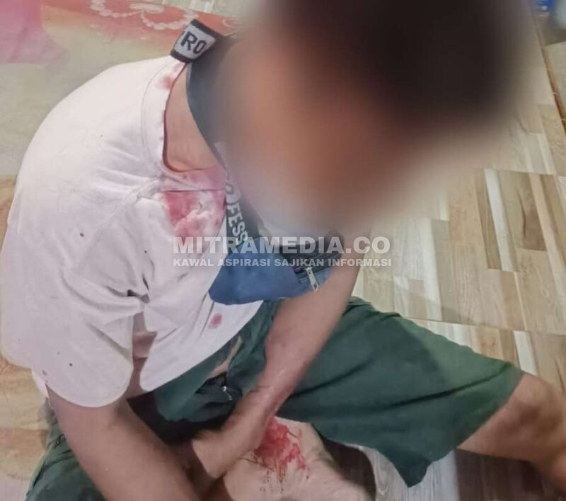 Korban dengan kondisi berlumuran darah usai dihajar oleh pelaku. (Anang/MITRAMEDIA) 